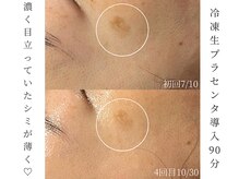 シストワ(sistoi)の雰囲気（シミの原因『メラニン』に生プラセンタの効果！メラニンを排出！）