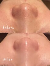 ケイカ 下北沢(KEIKA)/ララピール1回ビフォーアフター