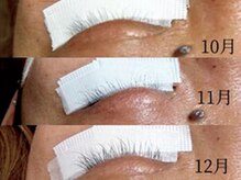 アイマジックピュア 一番町店(EYE MAJIC pure)/育毛まつげエクステでまつ育