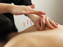 アリエス整骨院 恵比寿の雰囲気(鍼灸施術も可能【肩こり/腰痛/不眠/内臓不調/自律神経】)