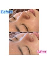 エムスラッシュアヴェダ 自由が丘(M.SLASH AVEDA)/スキンケア効果UP☆