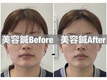 ハリサロンドオフ 堺東店(hari salon de off)/お客様before→after