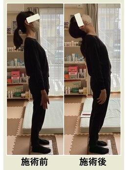 フリジア(Phrygien)/施術の変化