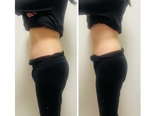 ヨサパーク プラム(YOSA PARK Plum)/before★after