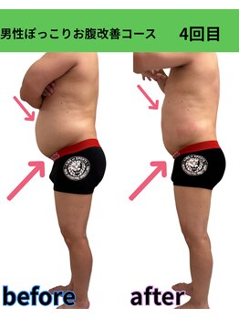 リラ(Lilas)/男性お腹改善 4回目