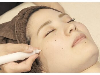 ジーニー(genie)/低周波シミケア