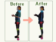 【痩身/ダイエット/整体/骨盤矯正】専門サロン アテオス/50代　腰痛・肩こり・腕の痛み