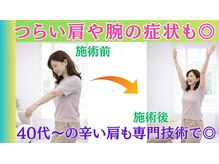 整体眞田流/肩や腕も専門技術でしっかり改善