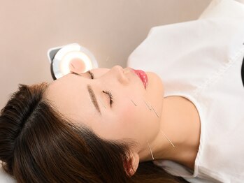 やわらぎ治療院の写真/鍼灸で健やかなお身体へ導く♪お悩みを丁寧な施術で改善へとサポートします！