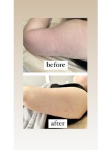 ビンナ 五反田店(Binna)/ハーブリプロボディー