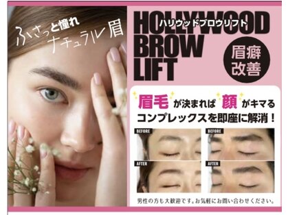 フレーズ(Fraise)の写真