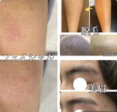 メンズエラ(MEN'S ERAa.)