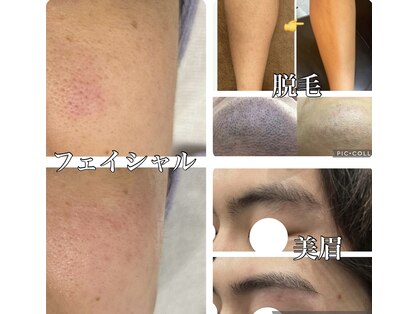 メンズエラ(MEN'S ERAa.)の写真