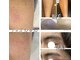 メンズエラ(MEN'S ERAa.)の写真