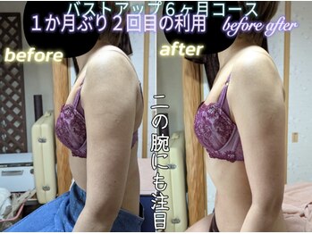 スノードロップ(snowdrop)/ブライダルエステにもピッタリ☆