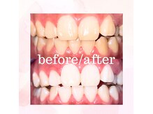 ホワイトサロン