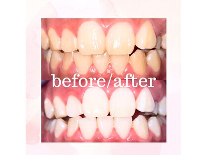 ホワイトサロンの写真