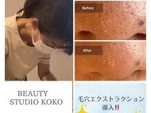 ココ(Koko)