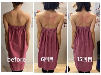 ロココ 四日市店(Rococo)/バスト以外も綺麗に変わります