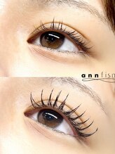 アンフィズム(annfism)