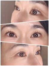 エンジェル(Angel)/マツパ