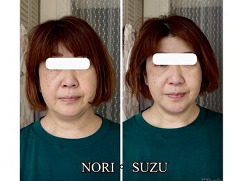 ノリスズ(NORI SUZU)/レッドショット脂肪分解