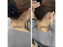 セルフ脱毛サロン　SELFMADE イオンタウン仙台泉大沢店【3/29 NEW OPEN（予定）】 /【ビフォーアフター】セルフ脱毛