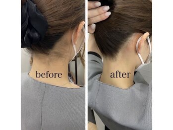 セルフ脱毛サロン SELFMADE イオンタウン仙台泉大沢店【3/29 NEW OPEN(予定)】 /【ビフォーアフター】セルフ脱毛