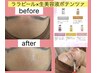 超集中ケアスペシャル★最新韓国生美容液＆《ララピールか光フェイシャル》