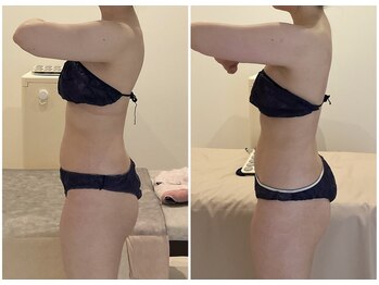 TMサロン 赤坂の写真/身体のゆがみ・反り腰・もっこり肩をケア！健康的痩せで理想のボディラインへ★