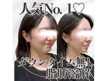ミタメ 銀座店(MITAME)の写真/【結果重視!!◎】芸能/モデル/花嫁様の方も多数ご来店♪最新【脂肪分解導入】で垢抜け美人☆360°美小顔!