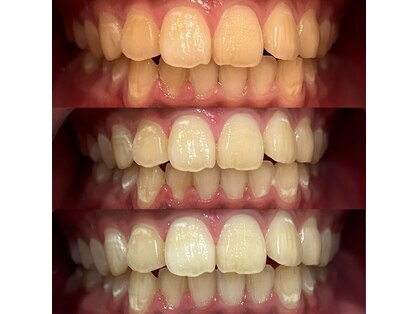 LUMI ホワイトニング&アイサロン 星ヶ丘の写真