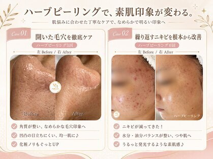 プリュボーテ(Pul Beaute)の写真