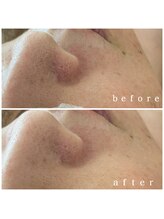 メナードフェイシャルサロン 岐阜茜部/柔肌/毛穴/透明感/リフトアップ