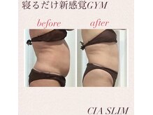 シアスリム(CIA SLIM)/劇的ビフォーアフター☆