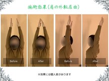 ボディ リセット アンド デザイン(Body Reset & Design)/【施術例】ビフォーアフター
