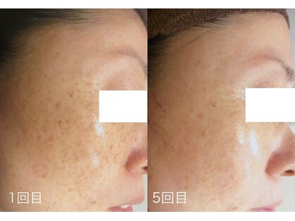 ブランシェ 富山店 × 椿の写真