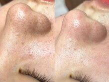 ルチア(Lucia)/透明感UP！滑らかな素肌に◎天神