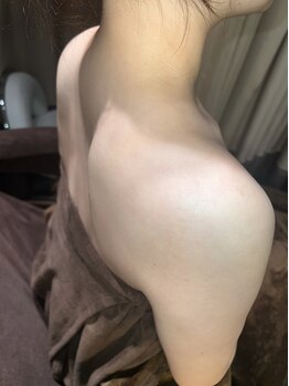 マーリィズエステティック(Marley's Aesthetic)/レディースシェービング