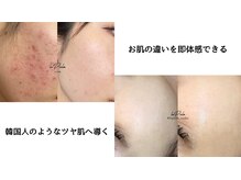 ラプア(Lapua)の雰囲気（結果重視！100人中100人が施術後のお肌に感動する仕上がりへ♪）