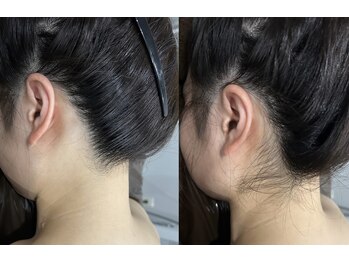 サロンリアンジュ ひたちなか店(Salon Liange)/うなじ綺麗ですか？うなじ脱毛