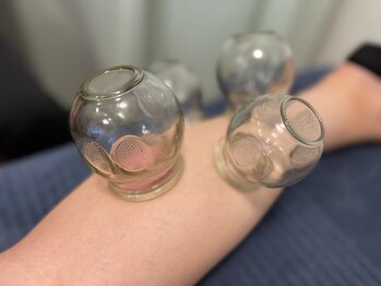 鍼灸院接骨院テトテ(tetote)/施術風景