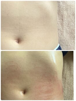 アスピリア(aspirer a')/全身痩身で痩せ体質へ導きます！