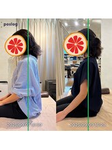 グレフル鍼灸接骨院 整体院 心斎橋/整体/肩こり/マッサージ/腰痛