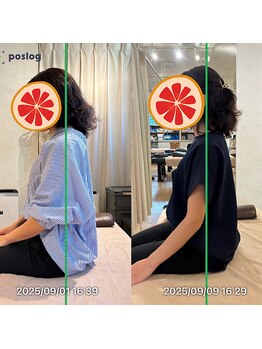 グレフル鍼灸接骨院 整体院 心斎橋/整体/肩こり/マッサージ/腰痛