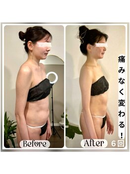 蒼(so)の写真/筋トレや機器を使用しても痩せないニの腕の原因→体の歪み(悪姿勢)。積み重ねた独自技術が,最高の完成度を!