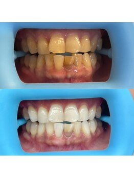 ホワイトニングセンター 富山二口店/富山 二口町ホワイトニング