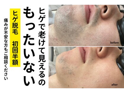 ジール(GIILL)の写真