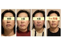 アロマリラクゼーションローザ(Roza)の雰囲気（メニュー名→背中から変わる＋小顔矯正リンパケア(90分)）