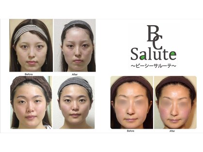 ビーシーサルーテ 茅ヶ崎駅前店(BCサルーテ)の写真